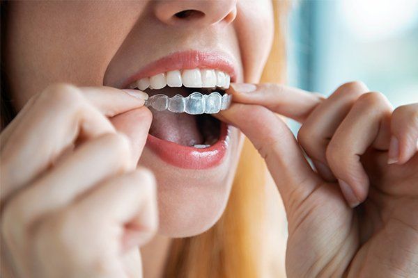 Orthodontics — Antioch, CA — New City Dental Practice