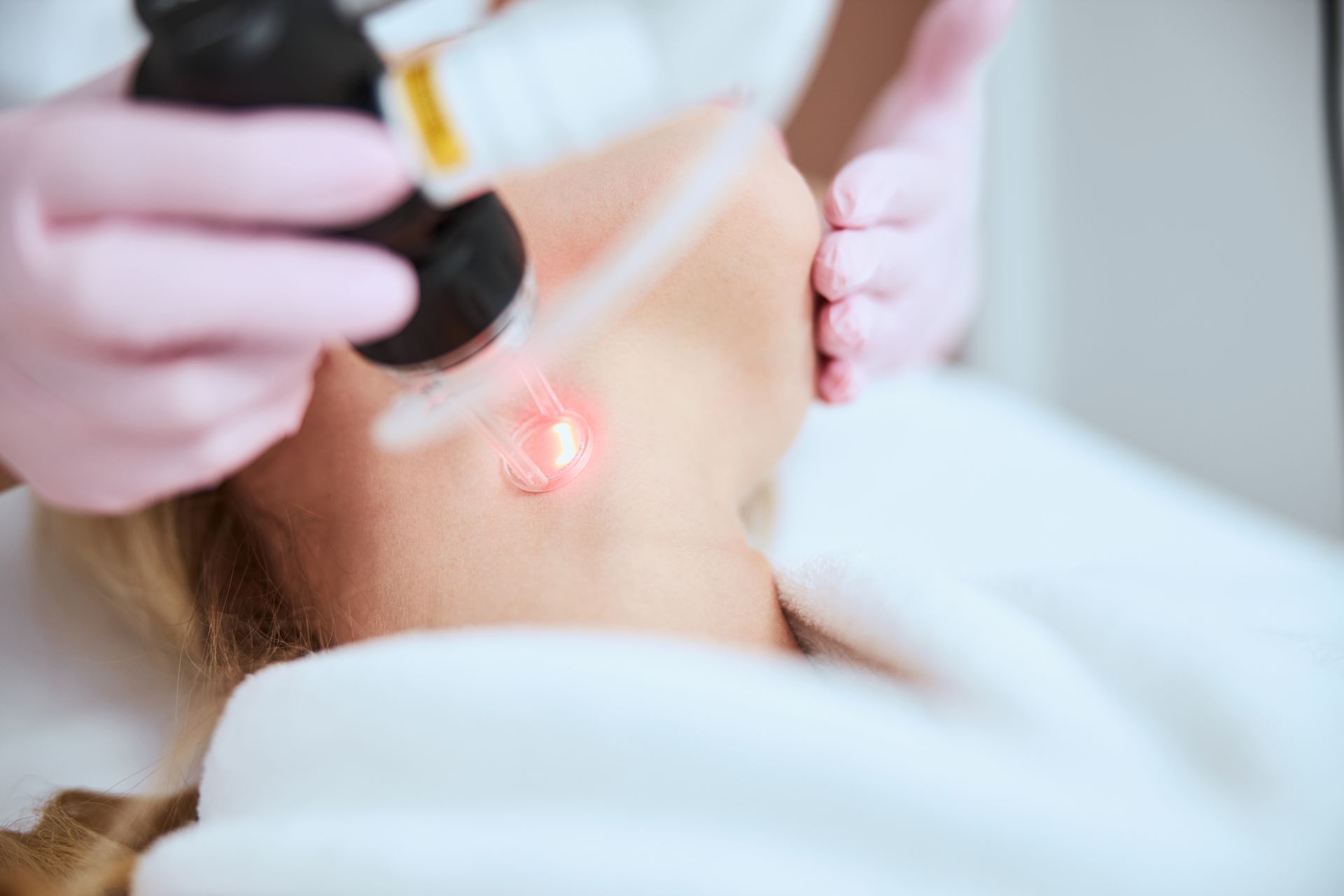 Hand holding a laser device near a neck during a skin treatment