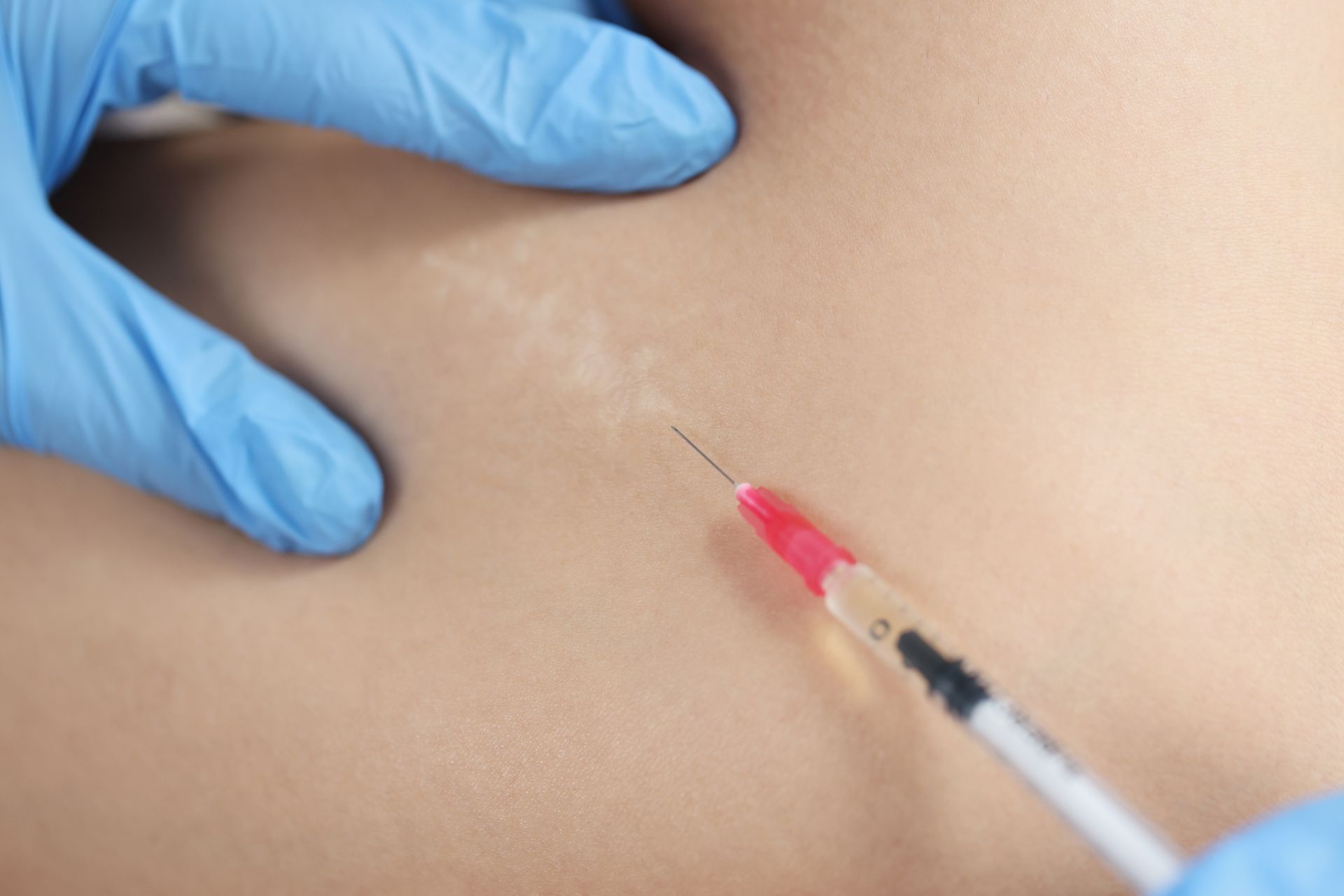 A close up of a person getting an injection with a syringe.