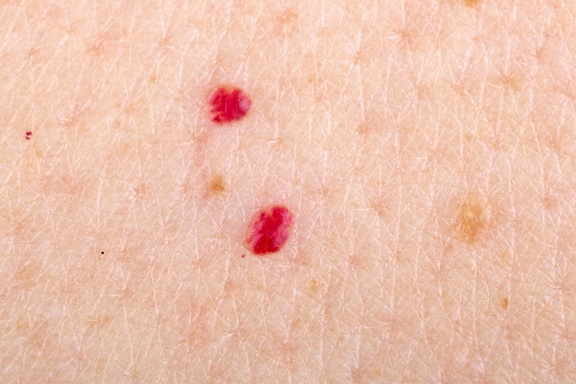 A close up of a person 's skin with red spots on it.