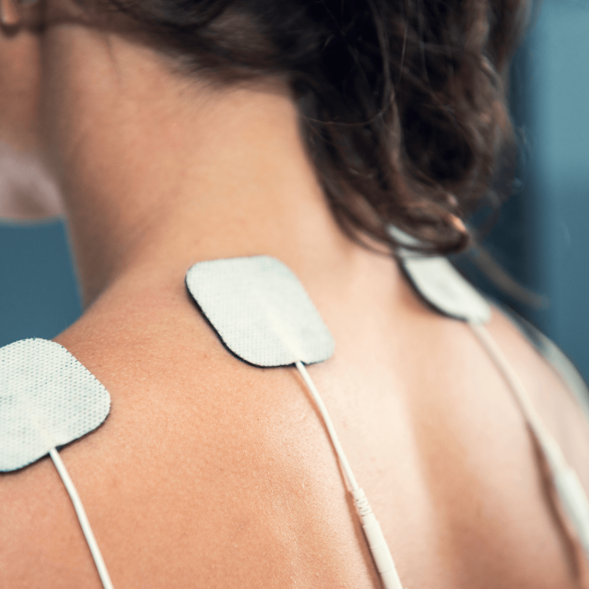 White electrode pads on a person's upper back and shoulders during electrical muscle stimulation treatment