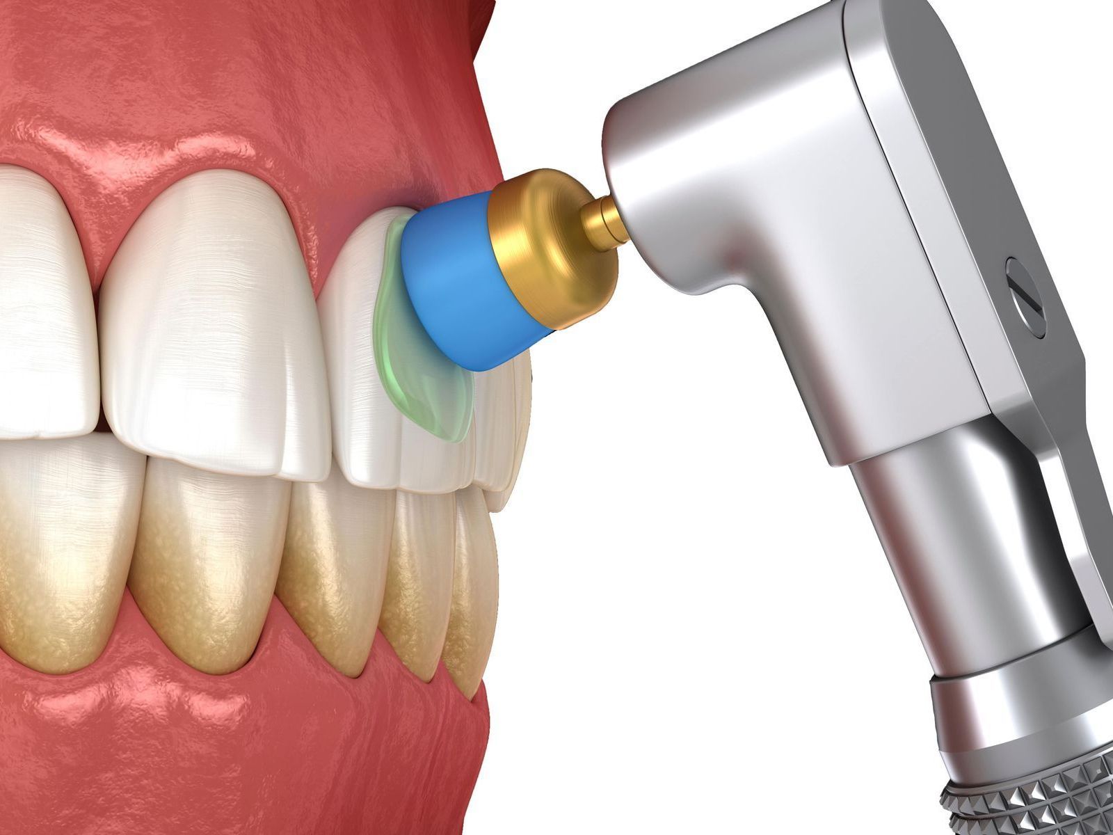 A close up of a person's teeth being brushed by a machine
