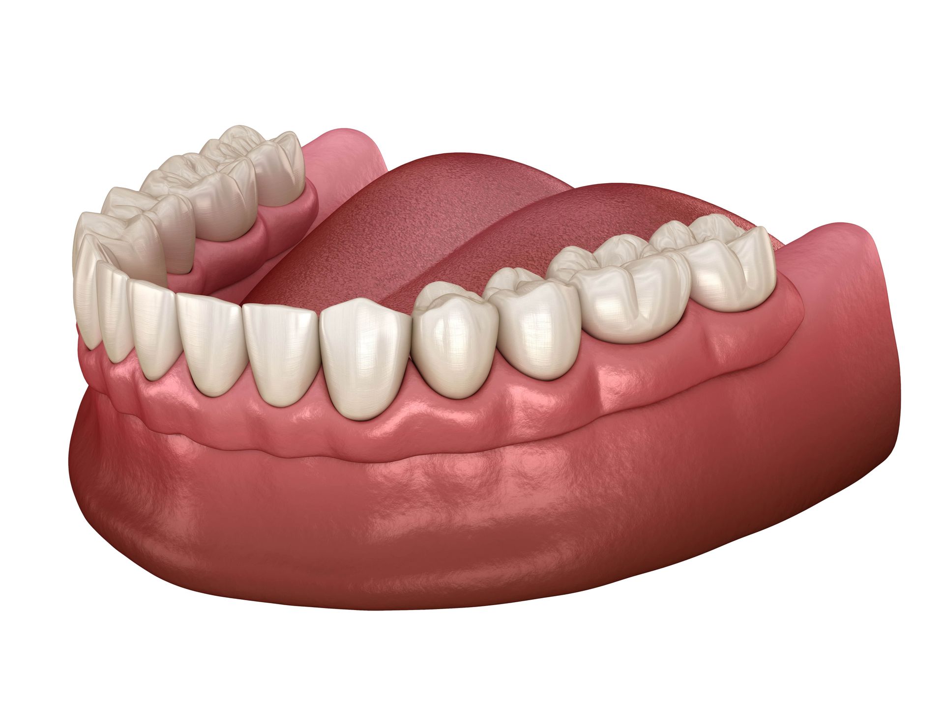 A computer generated image of a denture with teeth and gums