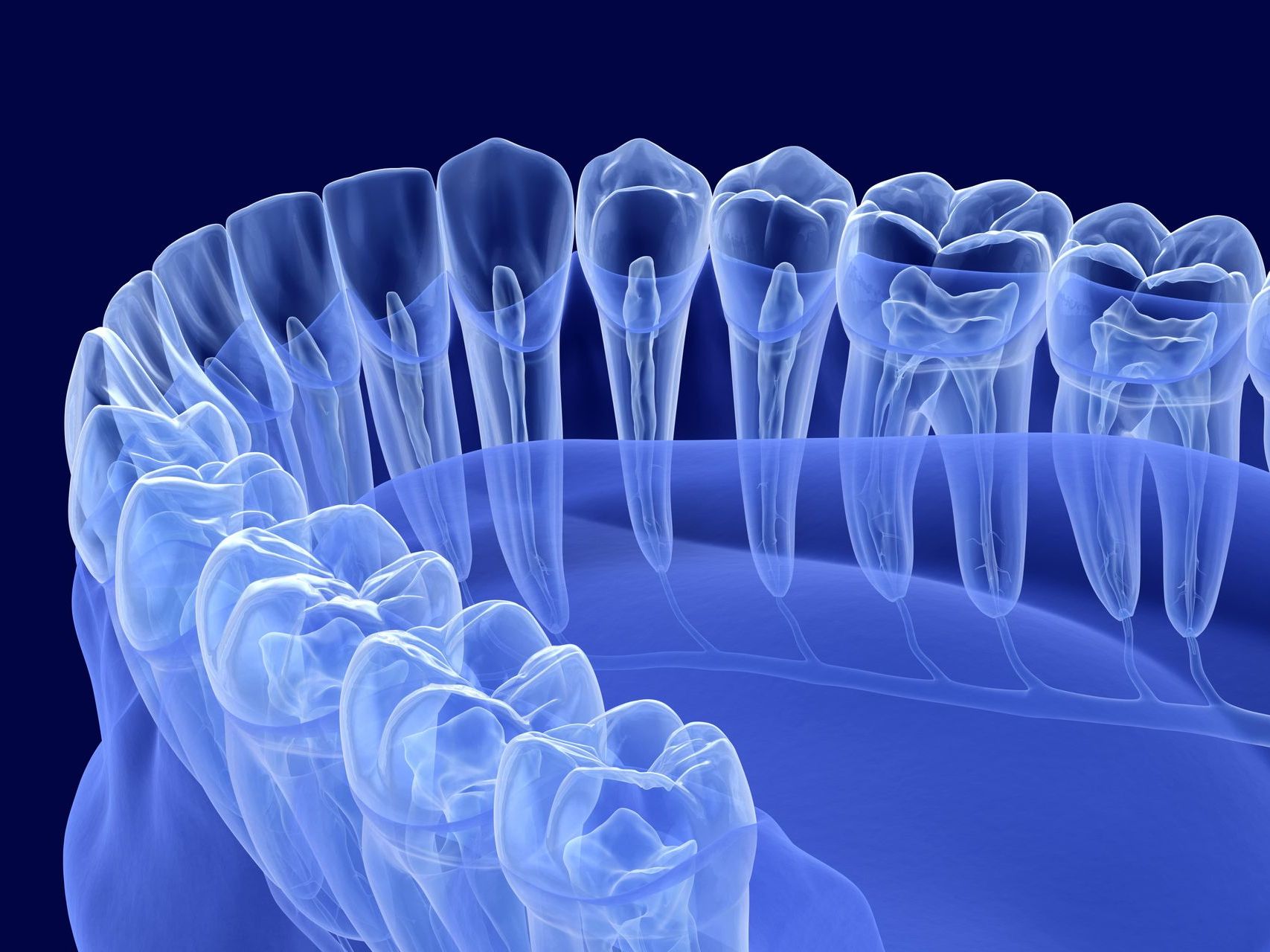 An x-ray of a person's teeth on a blue background