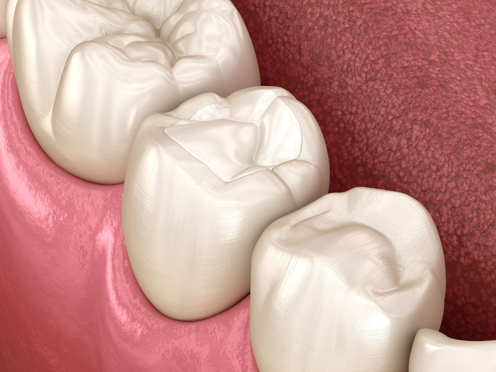 A close up of a row of teeth in a mouth.