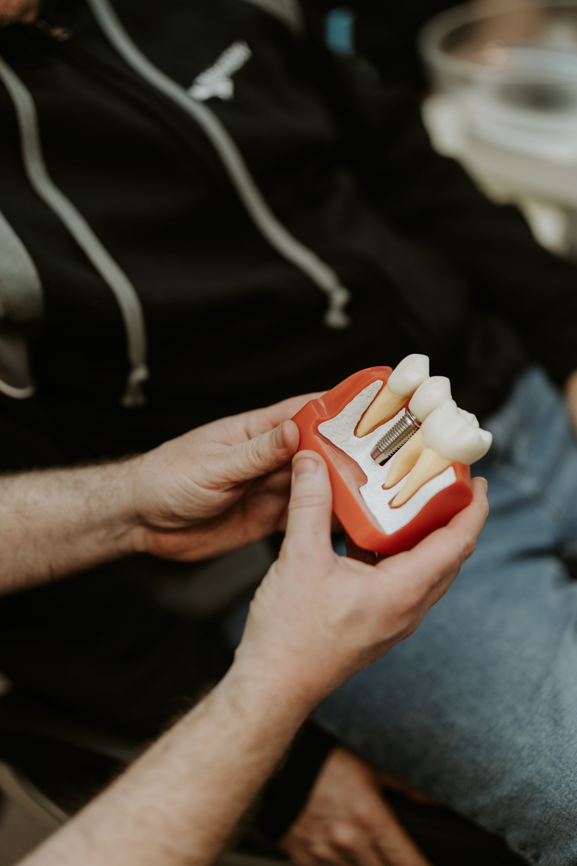 Hands Hold a Model of a Dental Implant — Dubbo Dental in Dubbo, NSW