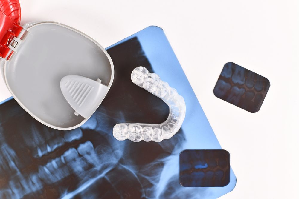A Clear Retainer is Sitting on Top of an X-ray — Dubbo Dental in Dubbo, NSW