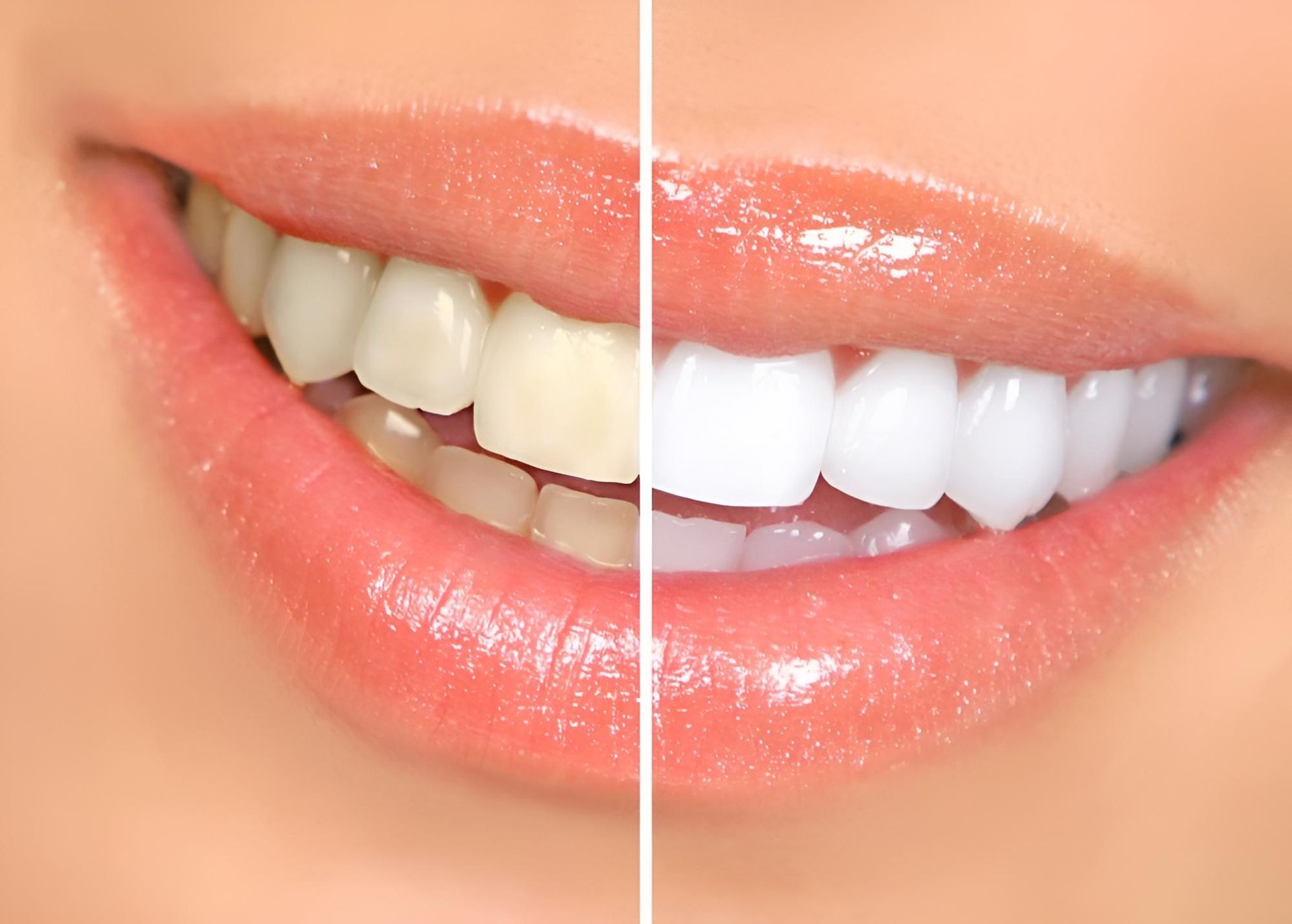 Picture of a Woman's Teeth — Dubbo Dental in Dubbo, NSW