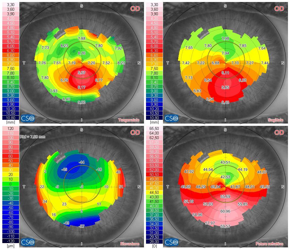 Quattro mappe di calore oculari suddivise in quadranti con scale di colore rosso, giallo, verde e blu ed etichette numeriche.
