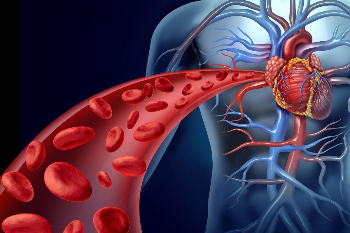 Aneurisma de aorta: saiba o que é e como tratar