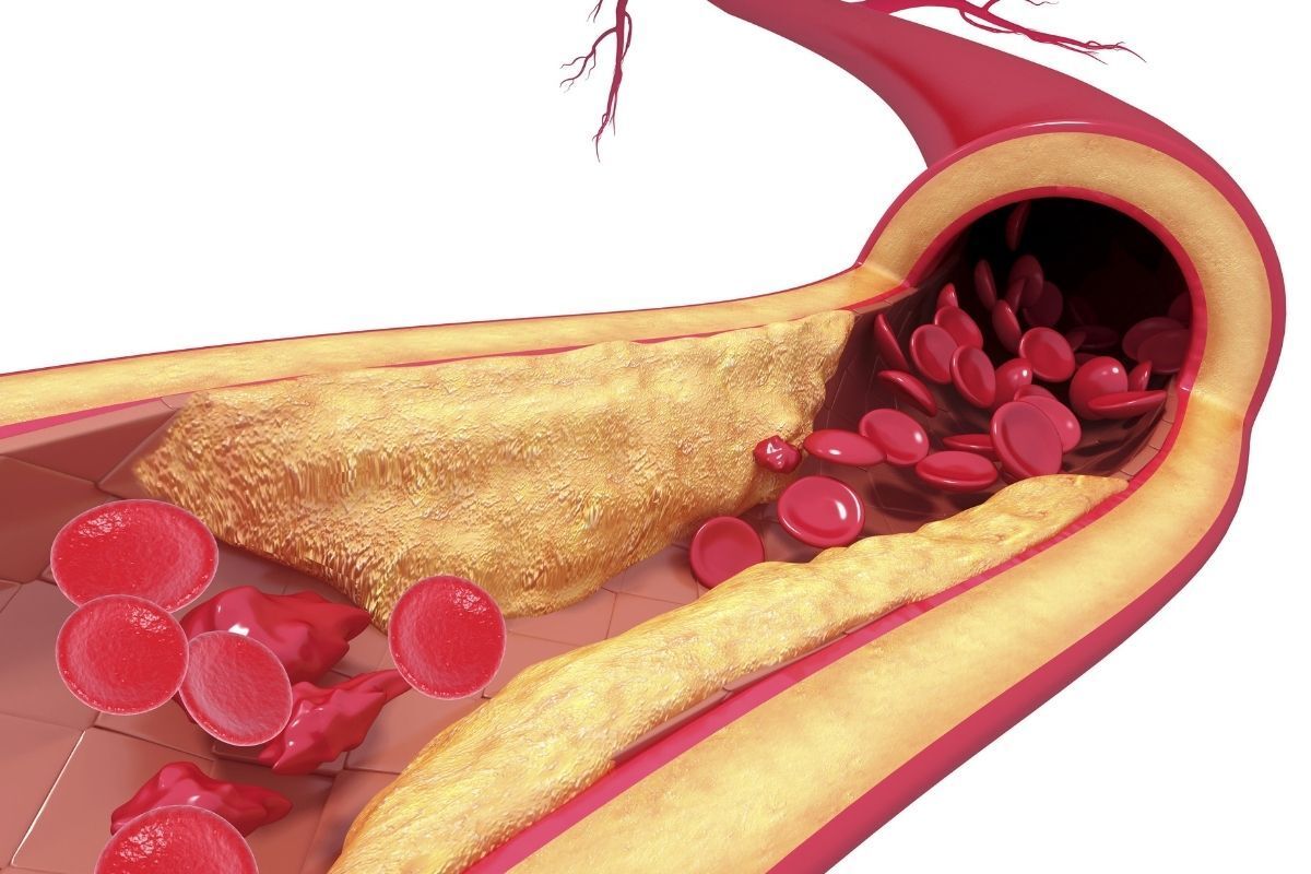 linica-vascullare-medico-vascular-foz-iguacu