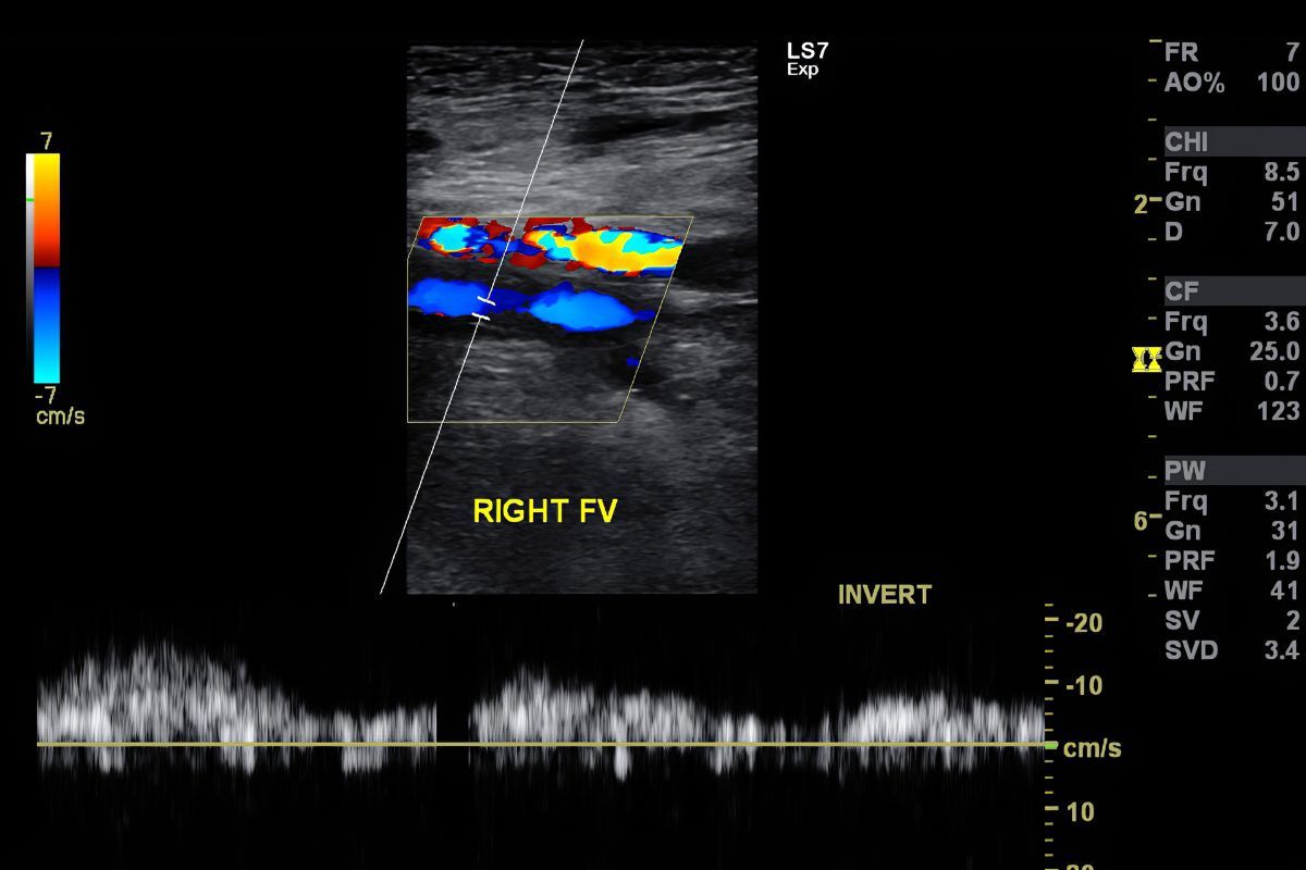 exame-doppler-clinica-vascullare-medico-vascular-foz-iguacu