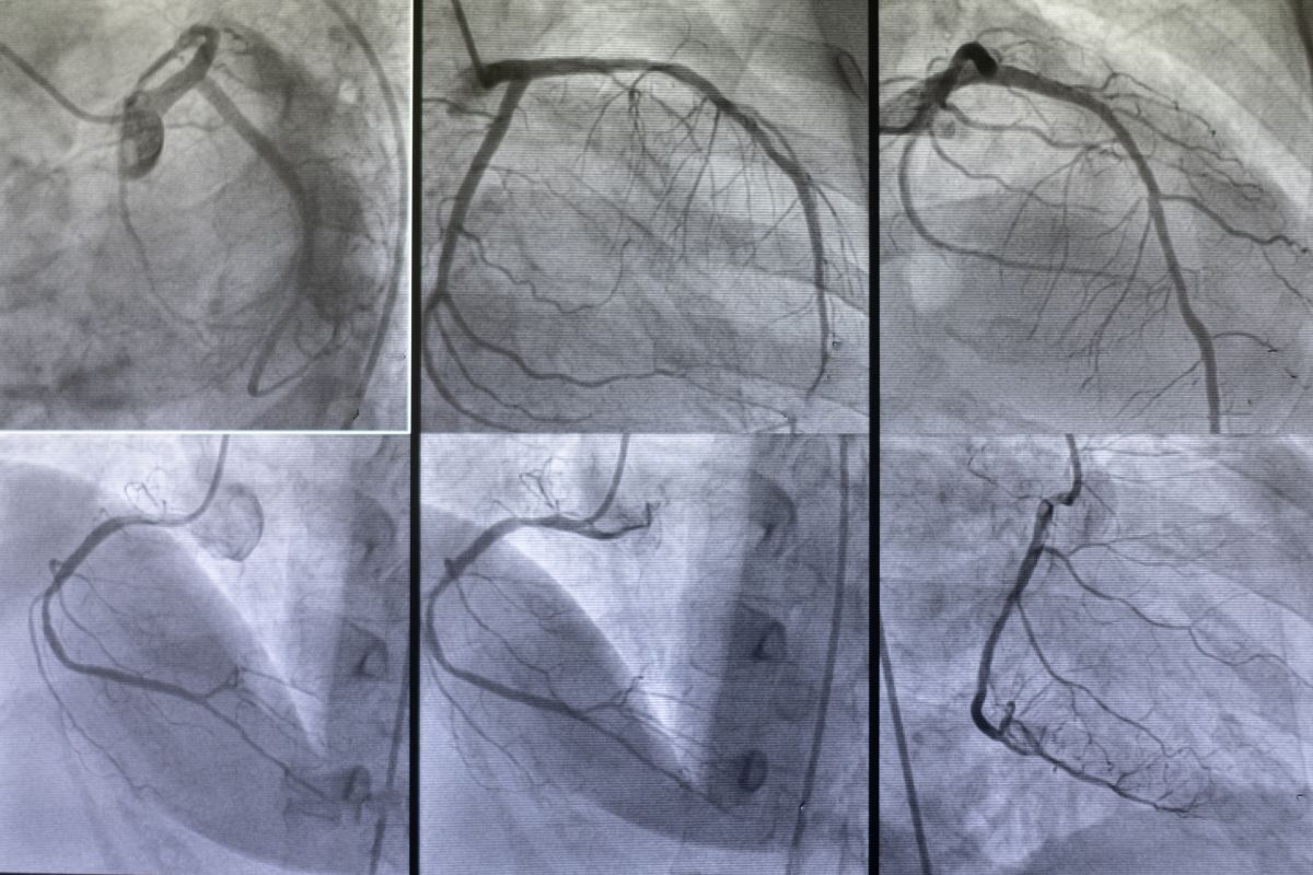 exame-vasos-sanguineos-clinica-vascullare-medico-vascular-foz-iguacu