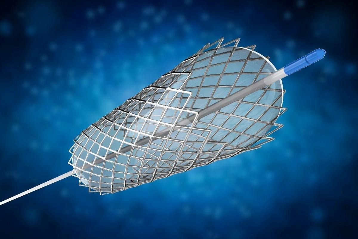 Tratamento endovascular: quais são as vantagens em relação à cirurgia convencional?