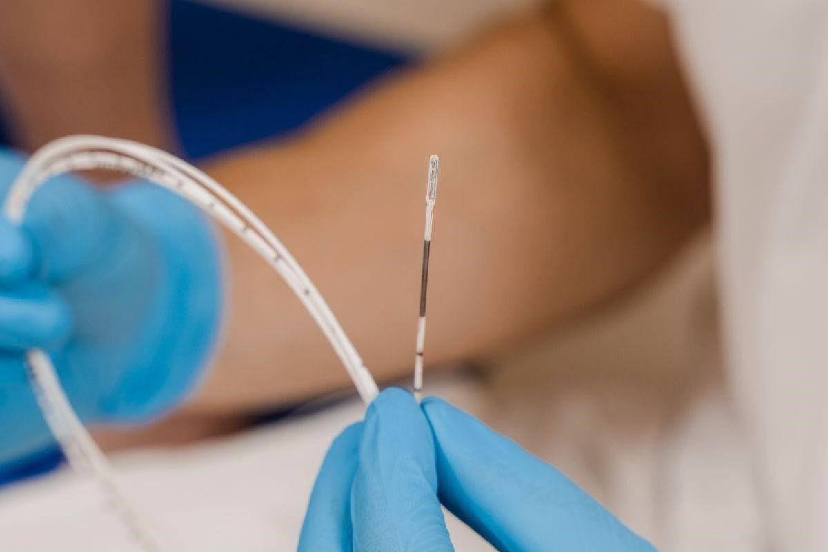 tratamento-varizes-endolaser-clinica-vascular-foz-do-iguacu