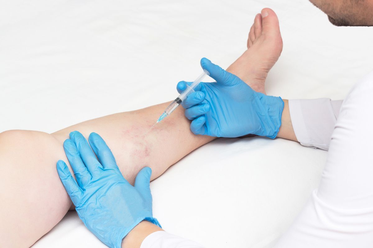 varizes-incomodam-clinica-vascullare-cirurgiao-vascular-foz-iguacu