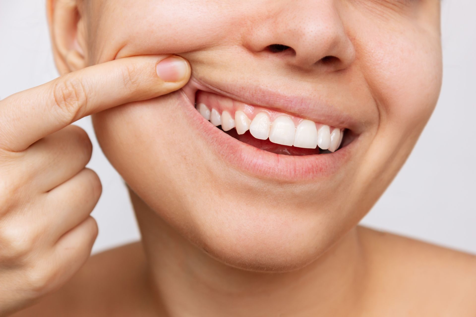 Woman smiling, pulling her cheek to expose teeth.