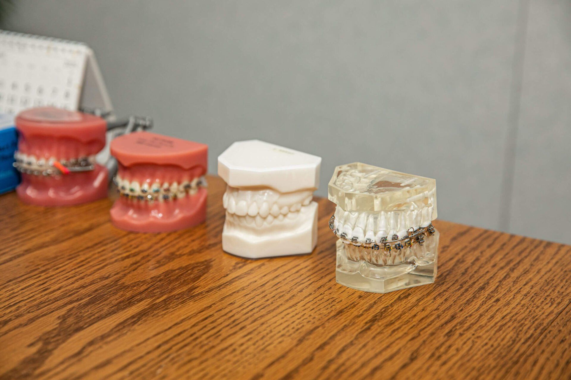 Three models of teeth with braces are sitting on a wooden table.