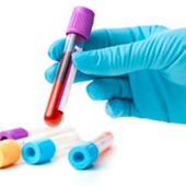hair loss bloodwork - biochemical report card for hair regrowth
