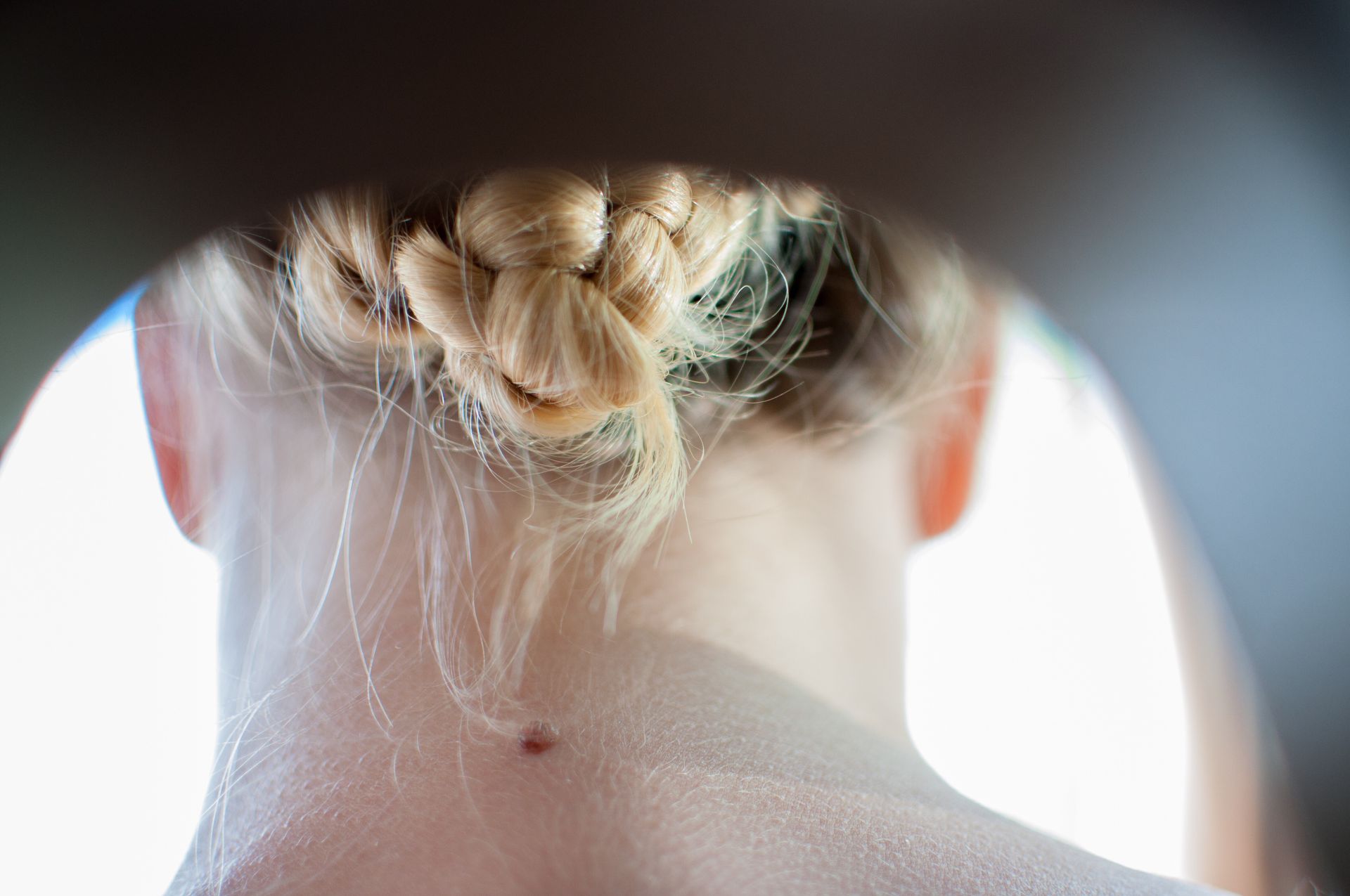 woman with skin tag