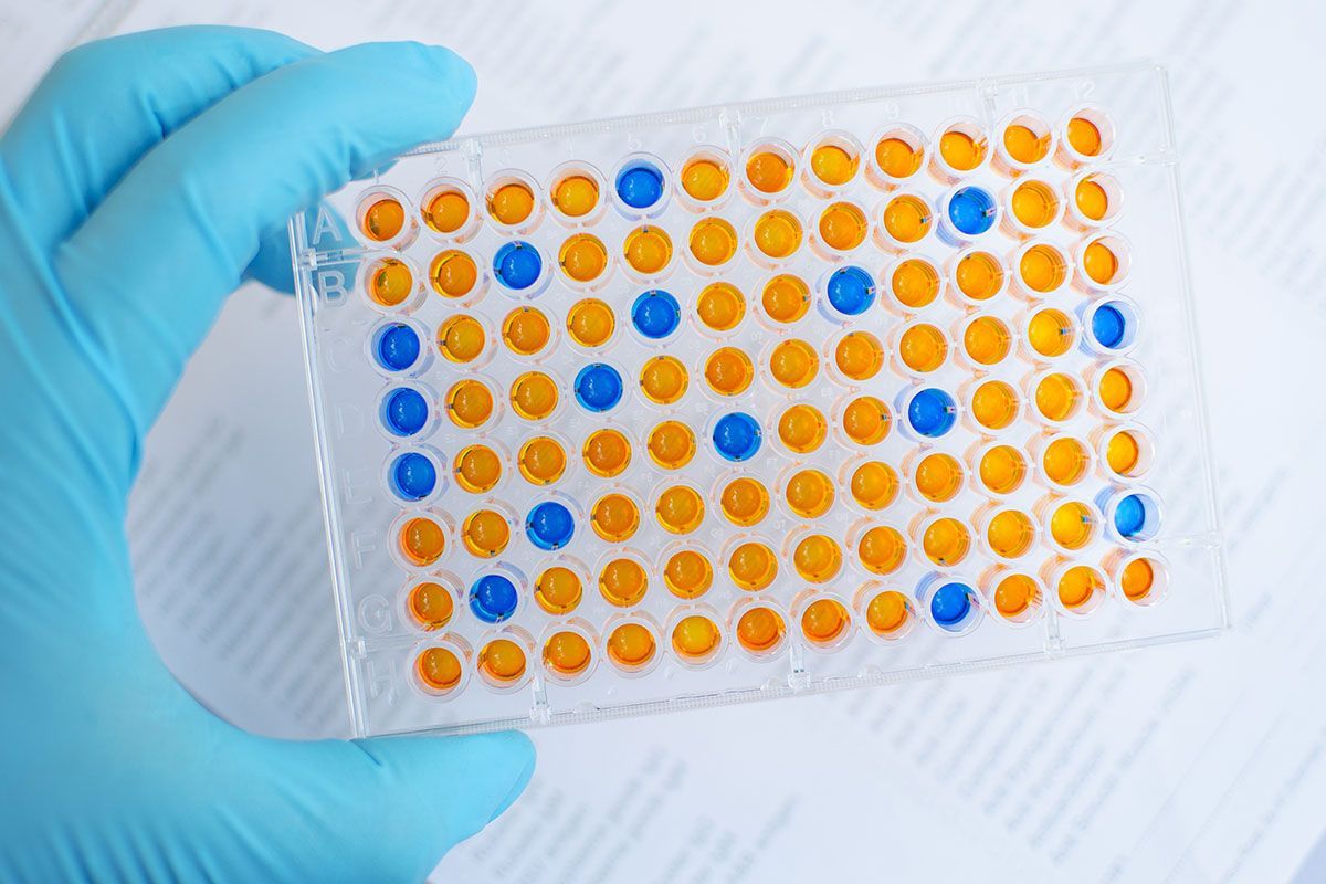 Gloved hand holding a lab microplate with colorful test wells