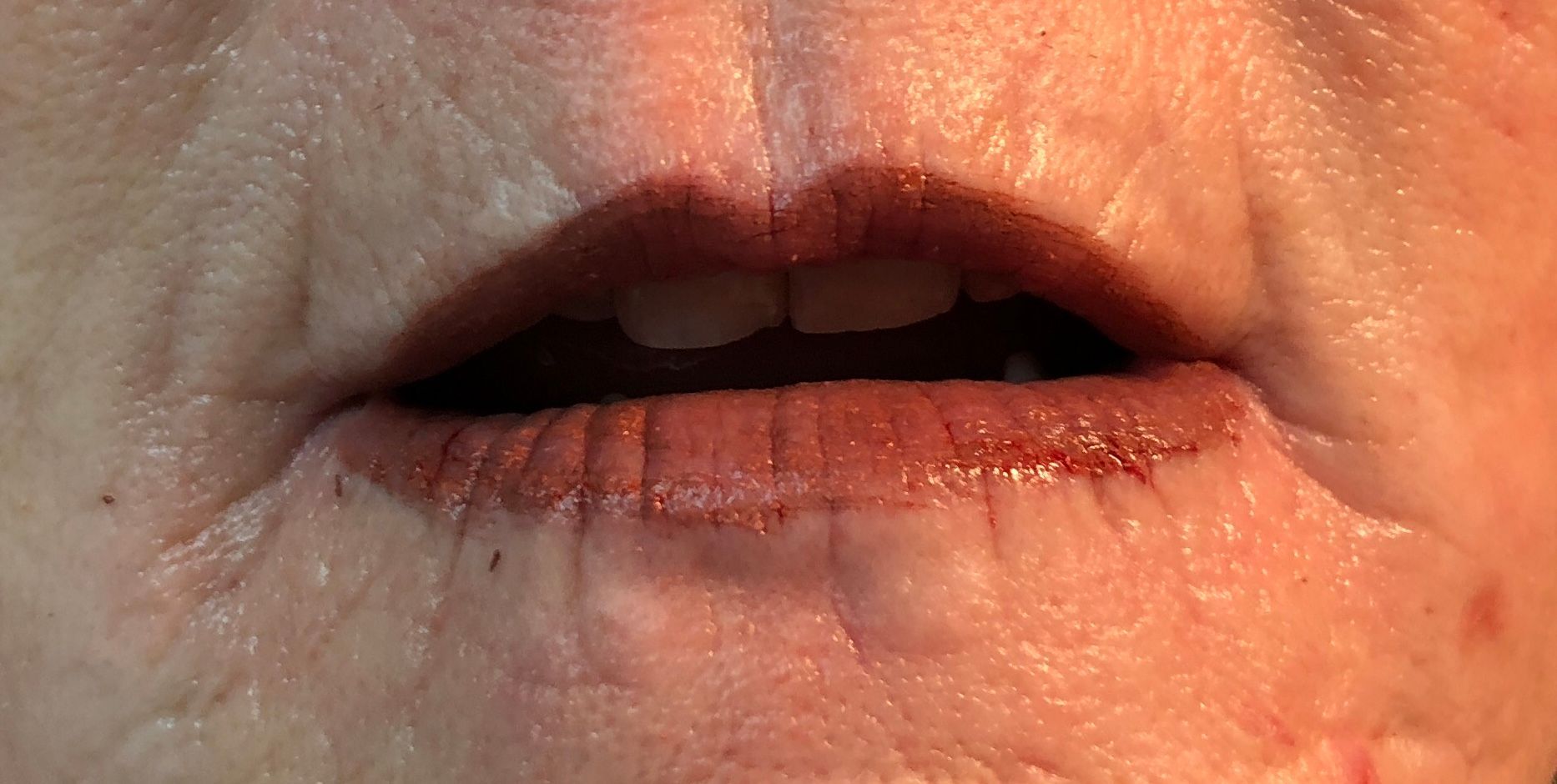after lip color