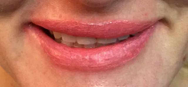 after lip color