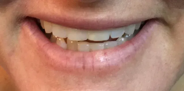 before lip color