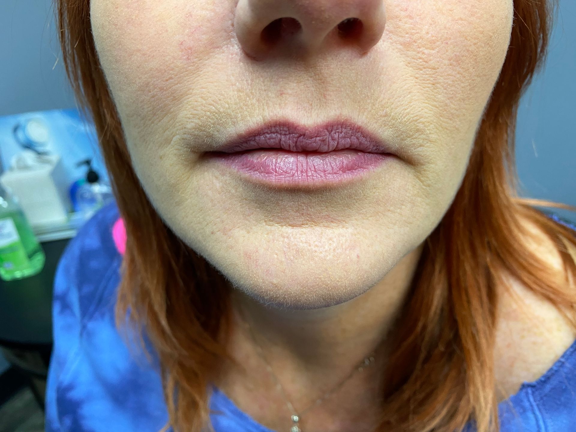 before lip color