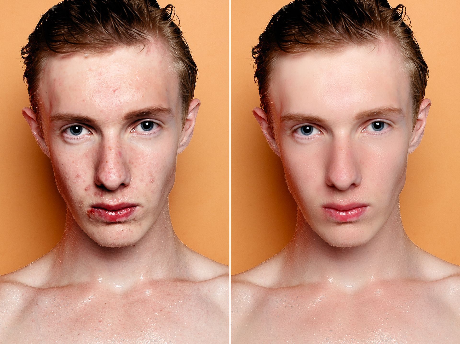 Comparison of a man's face before and after photo editing. The