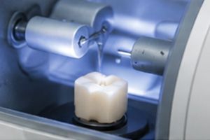 Dental milling machine cutting a white ceramic tooth crown in a blue-lit chamber