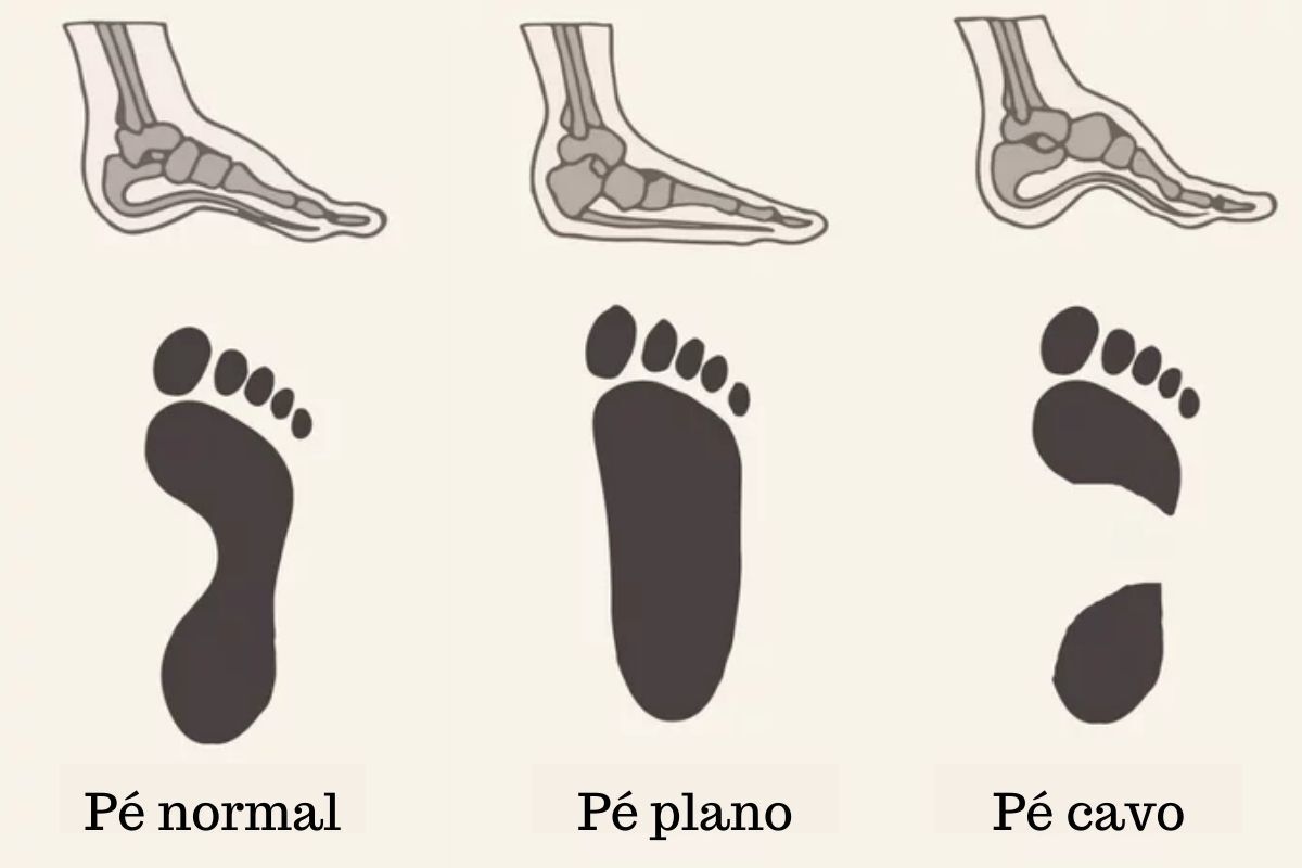 r-ivan-giarola-ortopedista-pe-tornozelo-sp