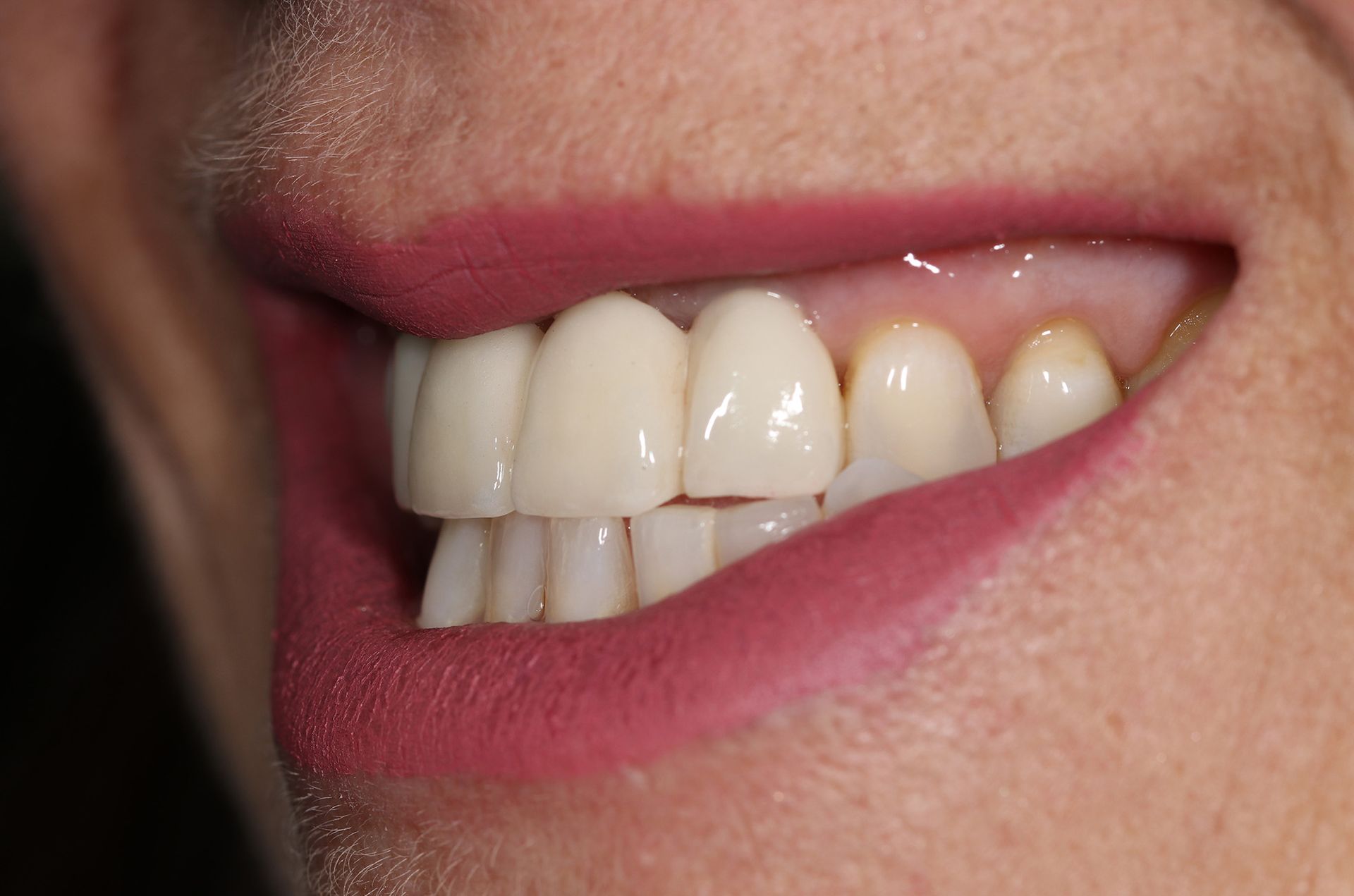 A close up of a person 's mouth with white teeth and red lips.
