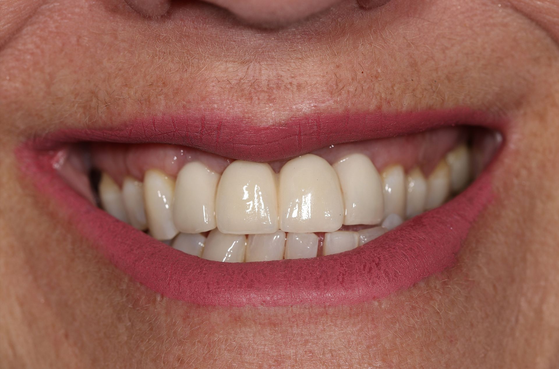 A close up of a woman 's smile with white teeth and red lips.