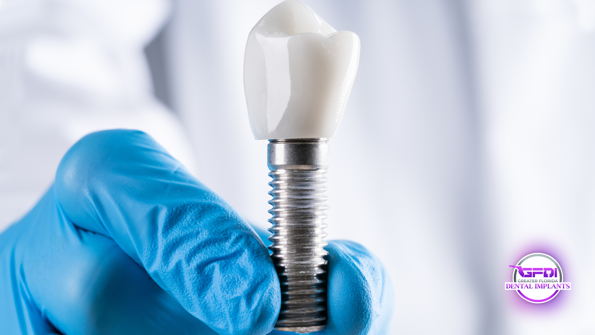 A dental implant held by a gloved hand, showcasing the metal post and ceramic crown.