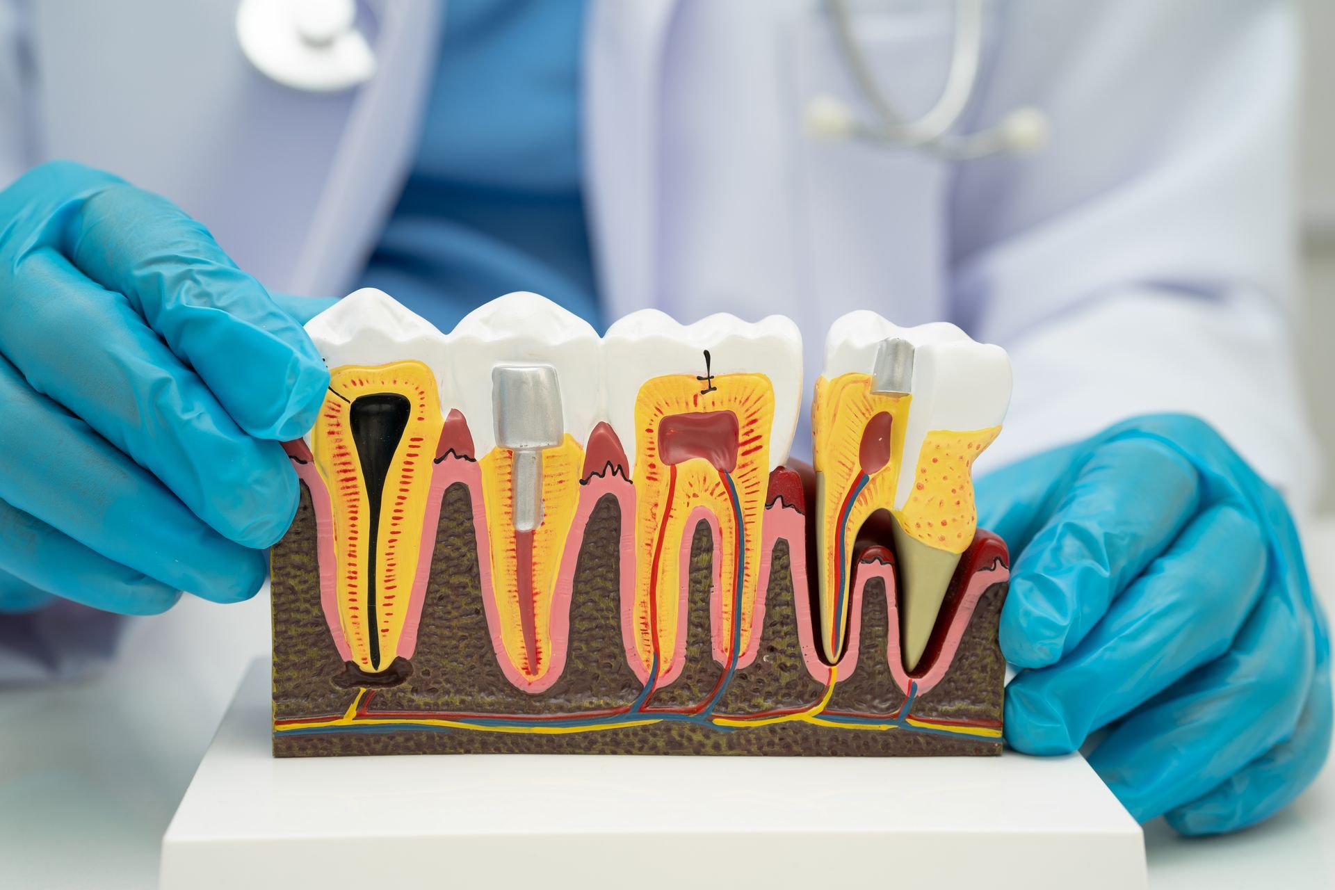 Gloved hands holding a dental model showing cross-section teeth and roots in a clinic setting