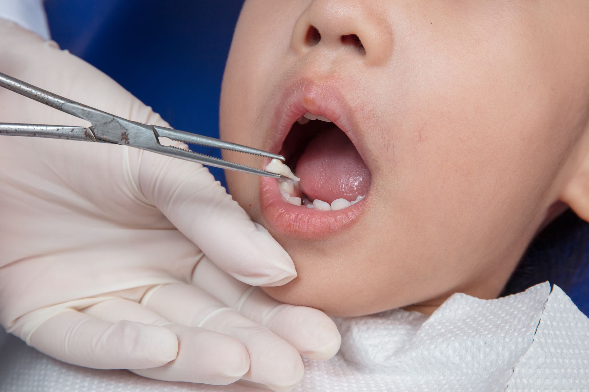 Gloved hand using dental tools to examine a child's open mouth