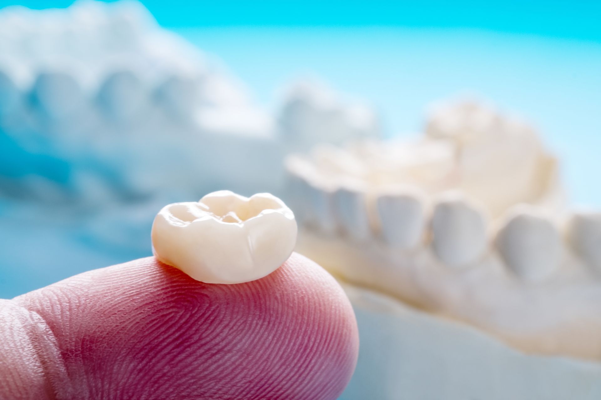 Tooth resting on a fingertip with blurred dentures in the background