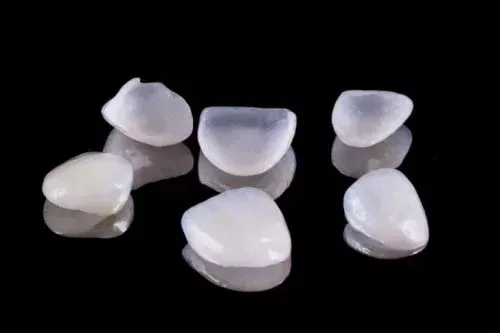 Implantologia dentale - Procedura di impianto