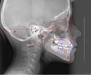 radiografia 3d
