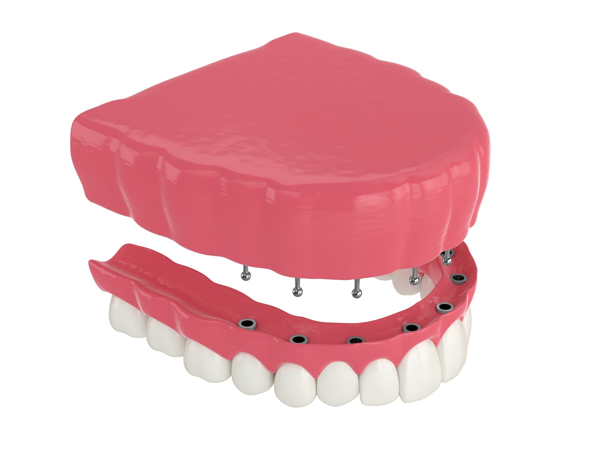 a model of a snap in denture
