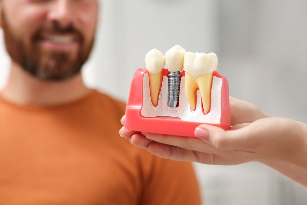a man is holding a model of a dental implant in his hand