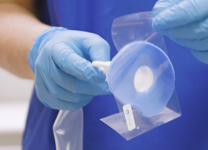 Blue dental impression tray held by a gloved hand against a light background