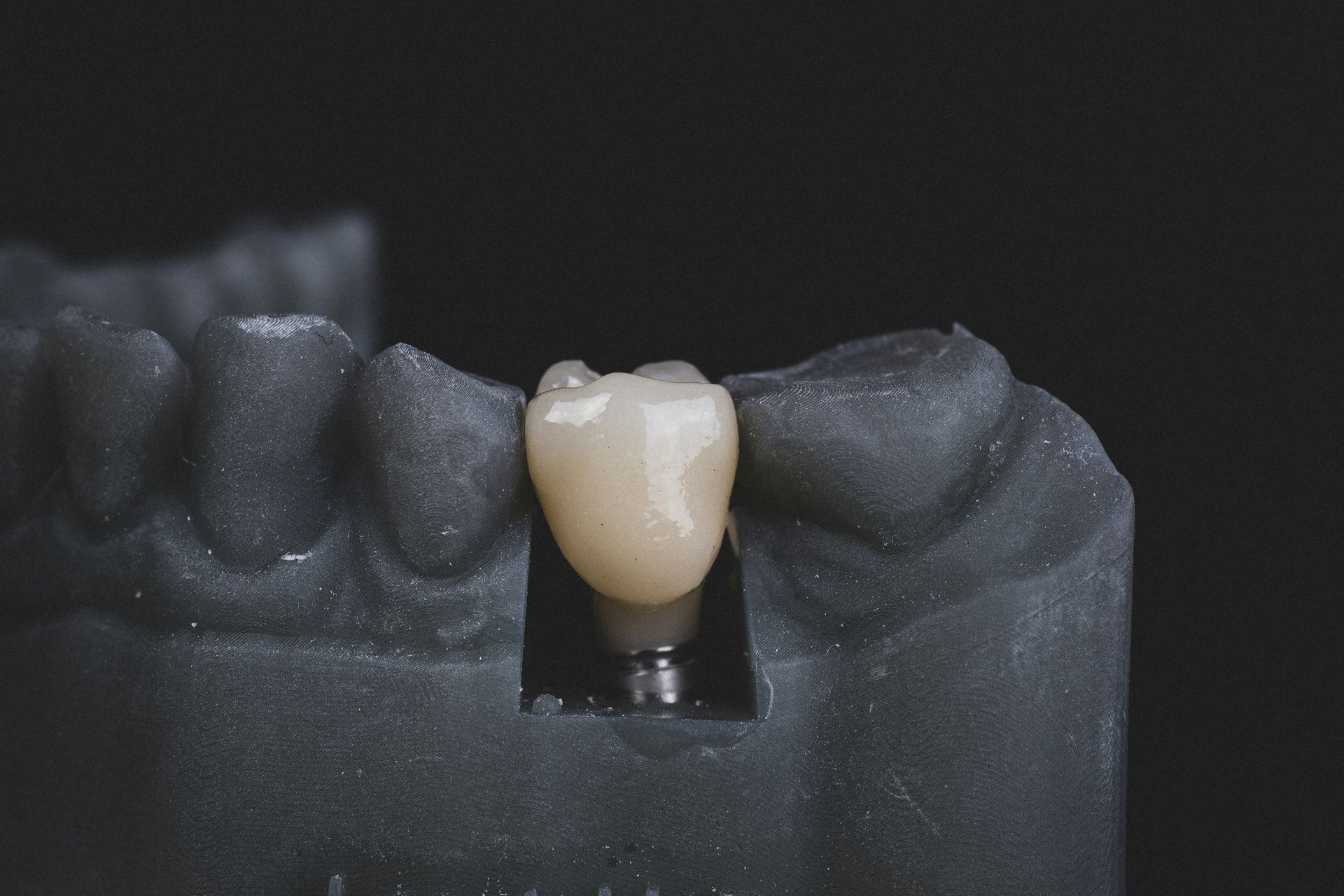 Single dental crown on a gray model tooth display.