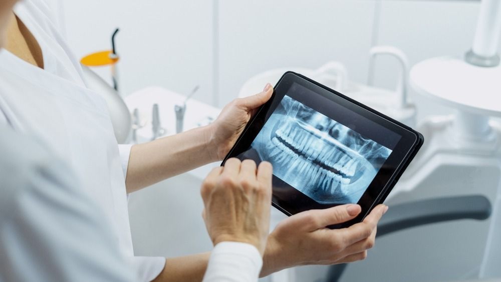 Dentist holding a tablet displaying dental X-rays in a bright clinic