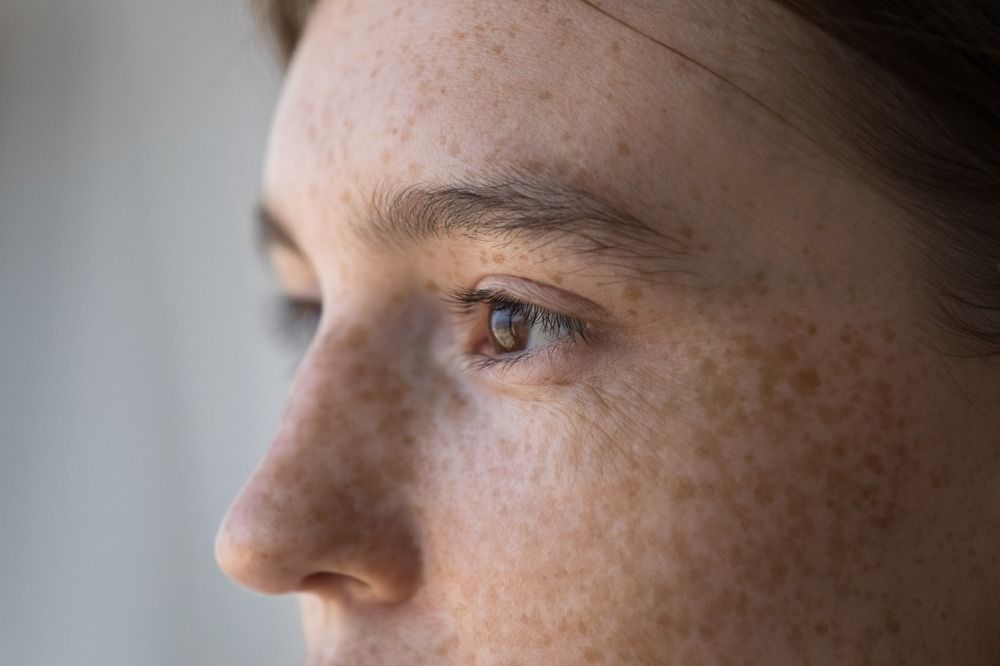 Close-up of a freckled face in profile, looking out a window with soft daylight.