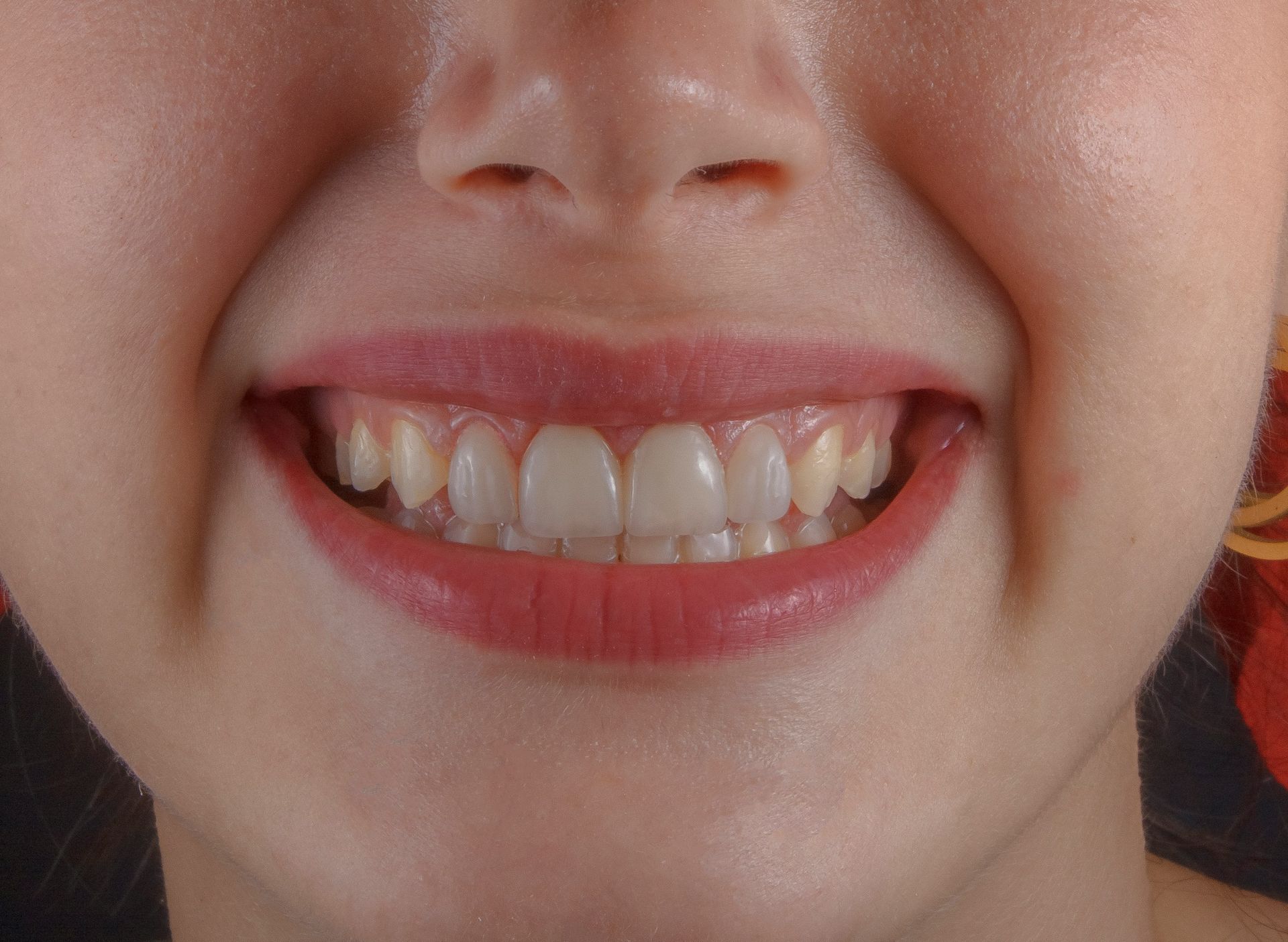 Close-up of a smiling mouth with visible teeth and pink lipstick.