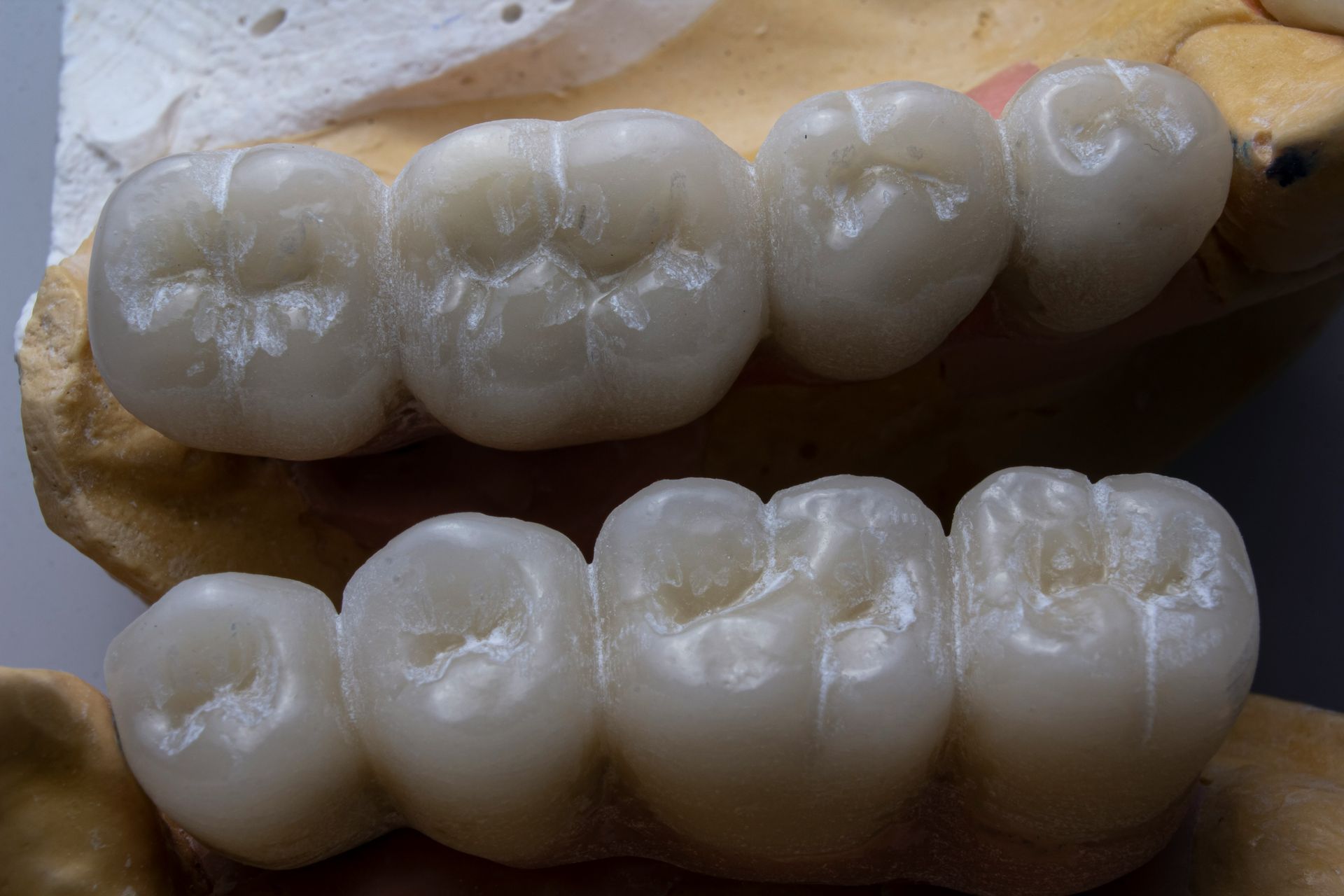 Two rows of white dental crowns on a tan surface.
