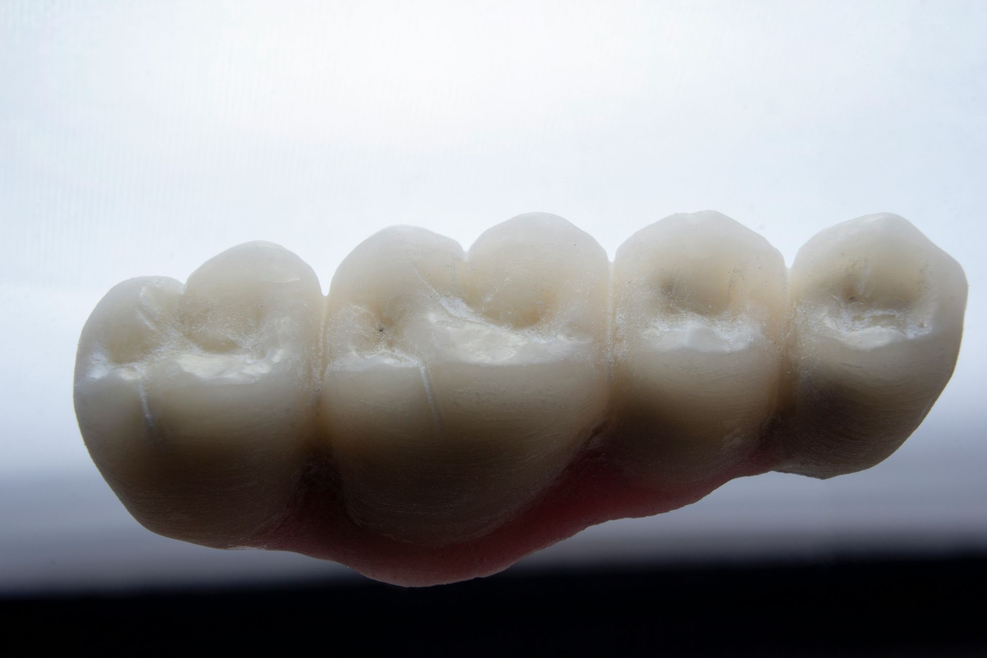 Close-up of a white molar tooth with visible grooves.