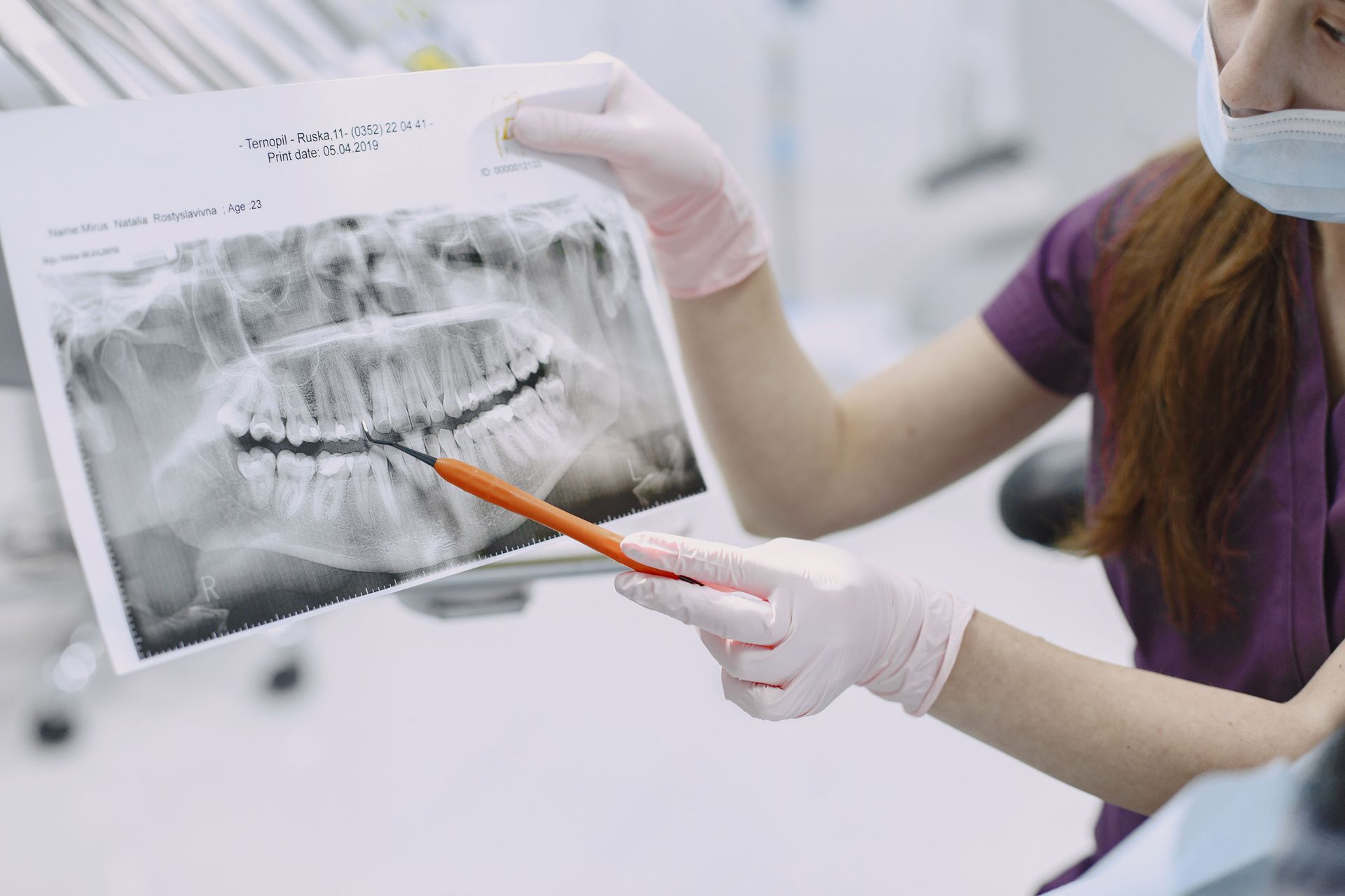 Dentist pointing at a dental X-ray with an orange pen while wearing gloves and a mask.